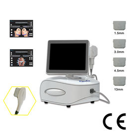 Body Shaping Machine HIFU Machine Improve The Sagging Phenomenon